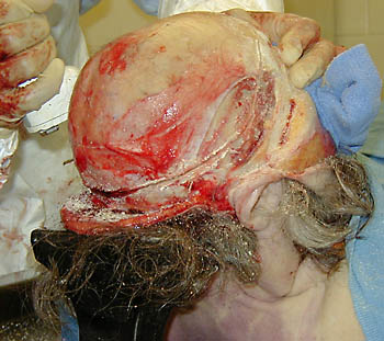 Head0010.jpg