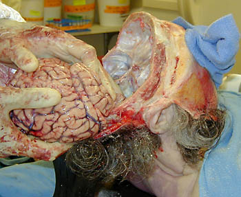 Head0013.jpg