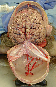 Head0012.jpg
