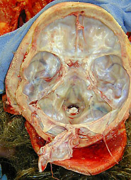 Head0014.jpg